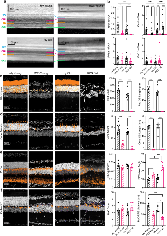 Light-induced charge generation in polymeric nanoparticles restores vision  in advanced-stage retinitis pigmentosa rats | Nature Communications
