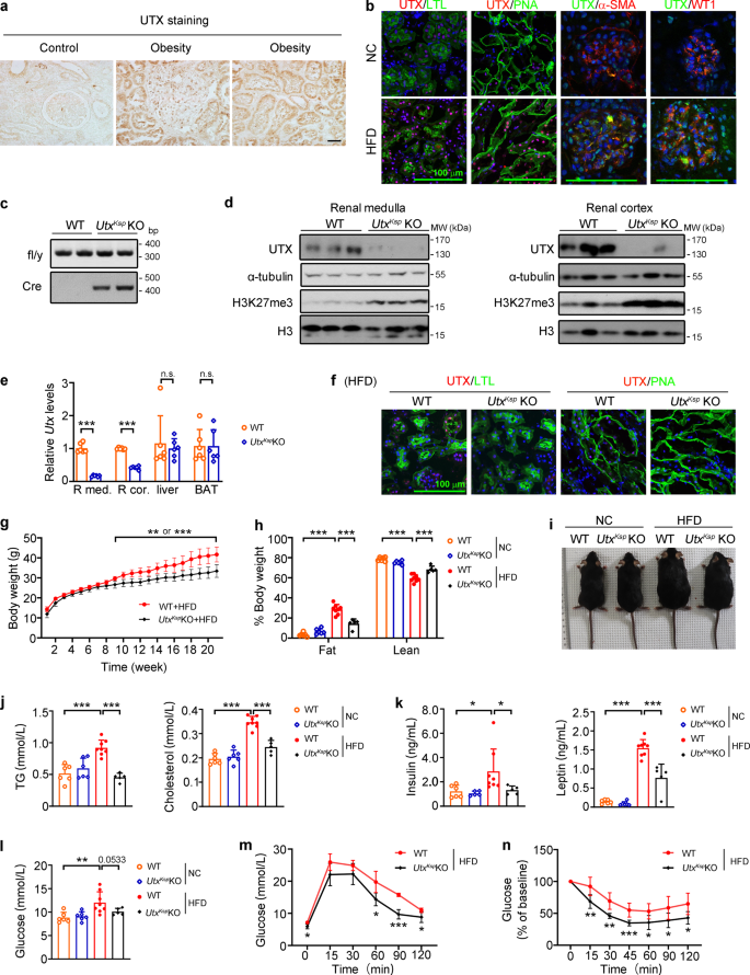 Renal Utx Phgdh Serine Axis Regulates Metabolic Disorders In The Kidney And Liver Nature Communications Renal Utx Phgdh Serine Axis Regulates Metabolic Disorders In The Kidney And Liver Nature Communications