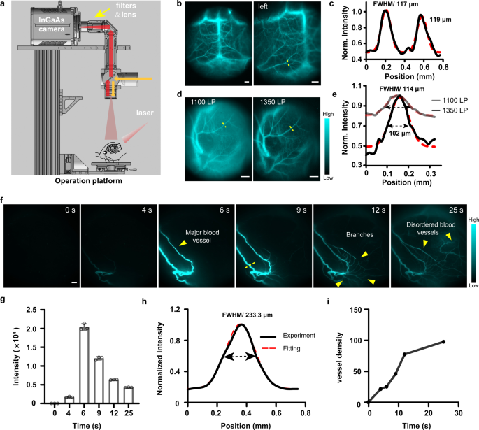 Fig. 5: In vivo NIR-II imaging for the vascular network of brain and tumor.