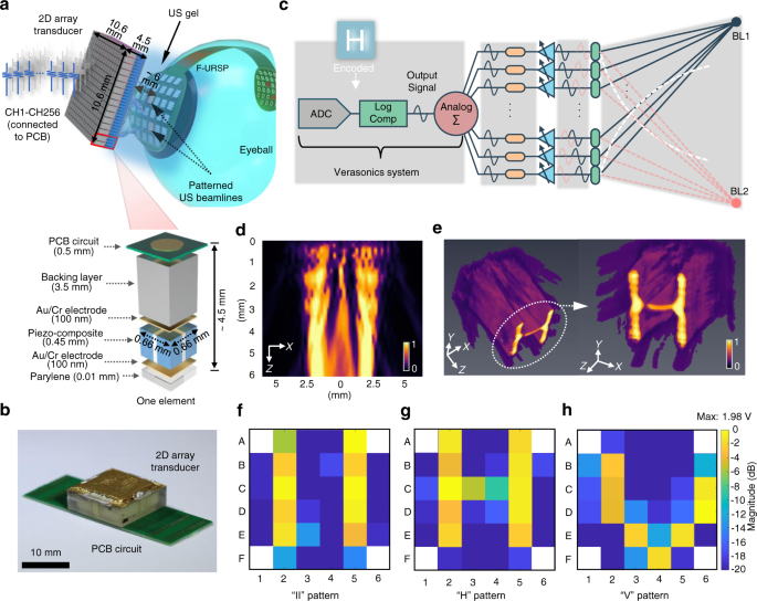Fig. 5: Recognition function induced by programmable acoustic field of a 2D array transducer.