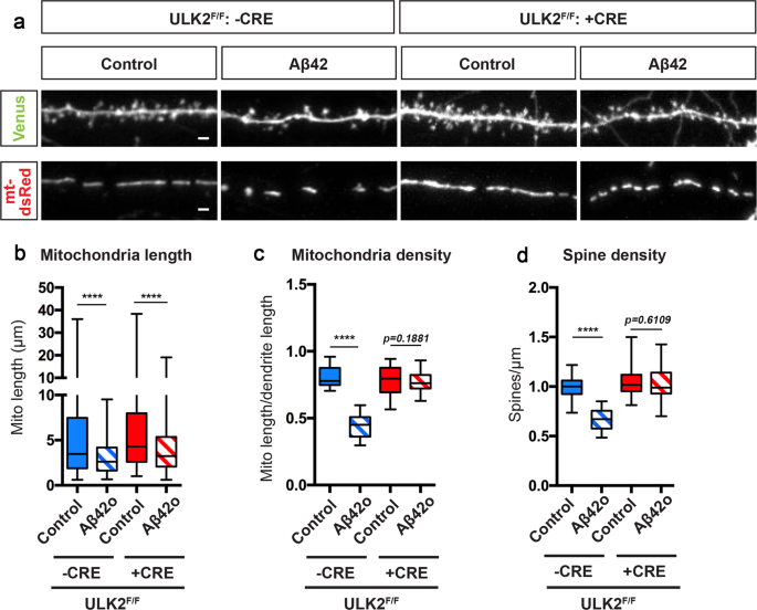 Fig. 8: ULK2 acts in a concerted manner with MFF and leads to loss of mitochondrial biomass following MFF-dependent mitochondrial fragmentation.