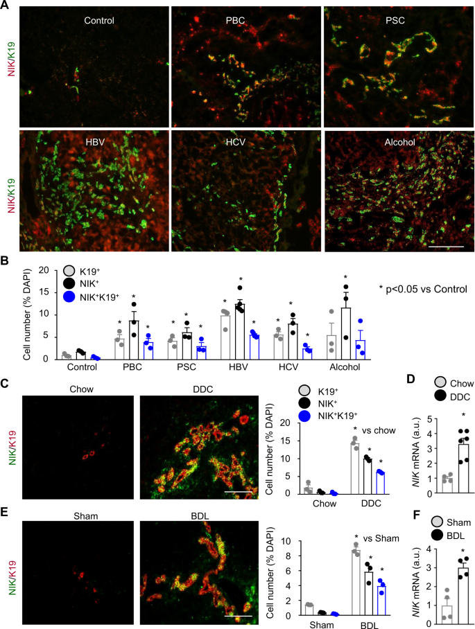 Biliary NIK promotes ductular reaction and liver injury and fibrosis in  mice | Nature Communications