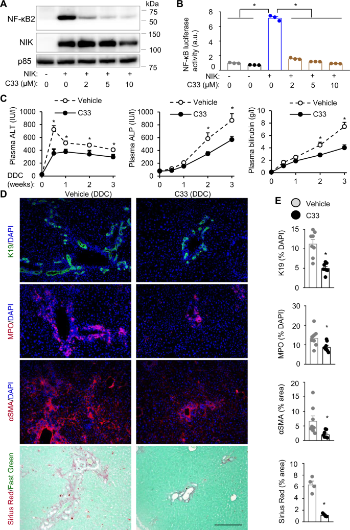 Biliary NIK promotes ductular reaction and liver injury and fibrosis in  mice | Nature Communications