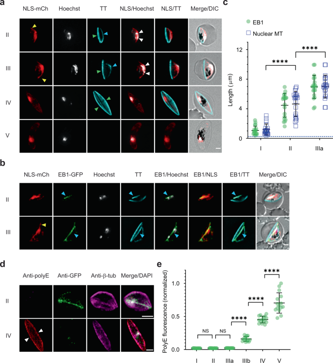 Fig. 2: End-binding protein-1 preferentially associates with the nuclear microtubules, while sub-pellicular microtubules are polyglutamylated.