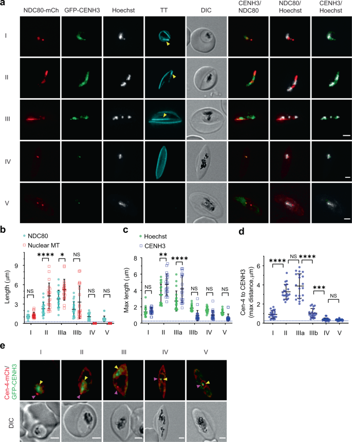 Fig. 4: Chromatin is repositioned along the nuclear microtubules in association with the centromeres and kinetochores.
