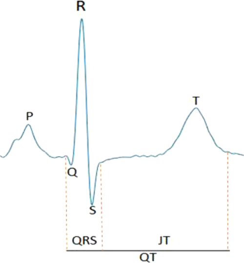 Fig. 1: Annotation of an example ECG signal.