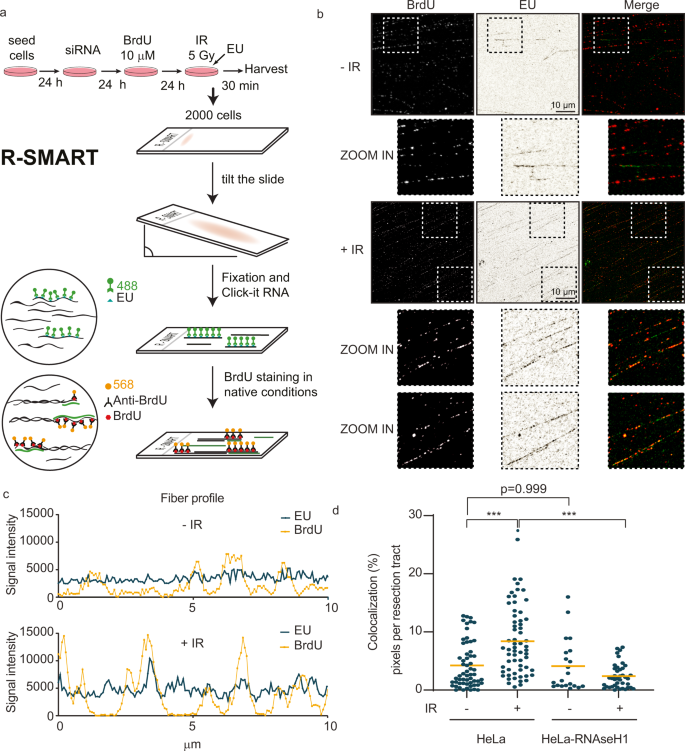 CtIP-dependent nascent RNA expression flanking DNA breaks guides the choice  of DNA repair pathway | Nature Communications
