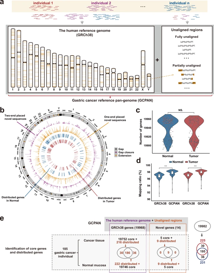 Pangenomic analysis of Chinese gastric cancer