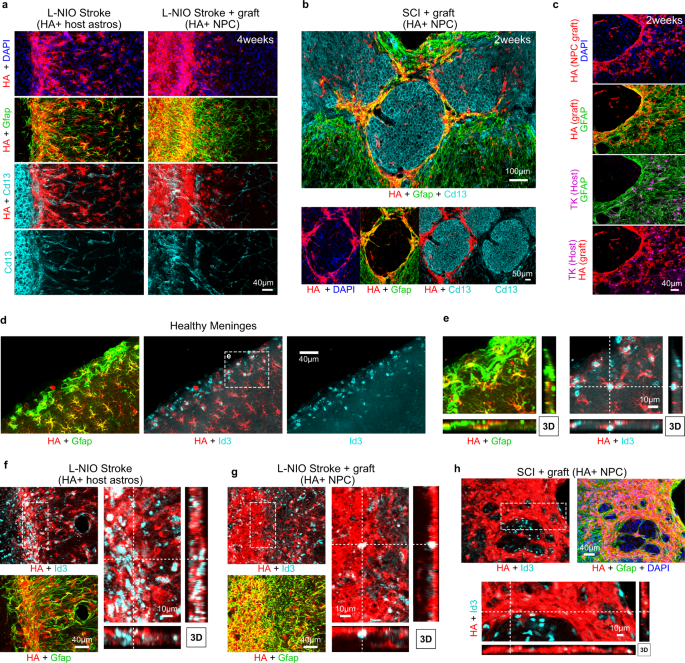 Fig. 6: Astroglia derived from NPC grafted into CNS lesions exhibit features of border-forming astroglia.
