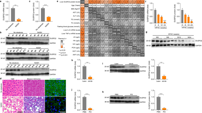 Fig. 1: DUSP22 is downregulated in fatty liver.