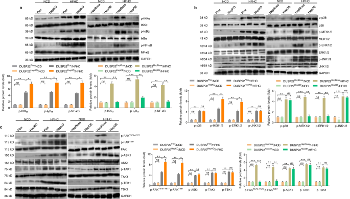 Fig. 4: DUSP22 regulates the hepatic activation of NF-κB and FAK signaling in HFHC-fed mice.