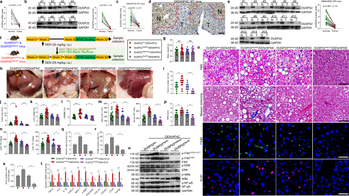 Fig. 8: DUSP22 ameliorates NASH-associated HCC.