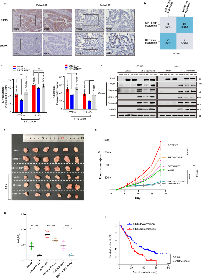Fig. 8: Levels of SIRT5 correlates with γH2AX and predicts outcomes in patients with CRC.