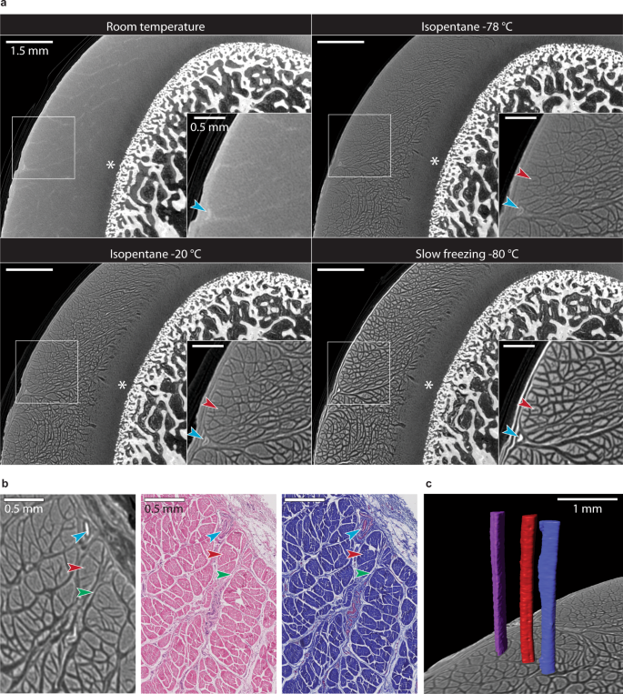 Contrast‐enhanced micro‐computed tomography of compartment and