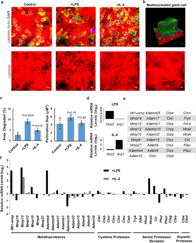 Basement membrane stiffness determines metastases formation