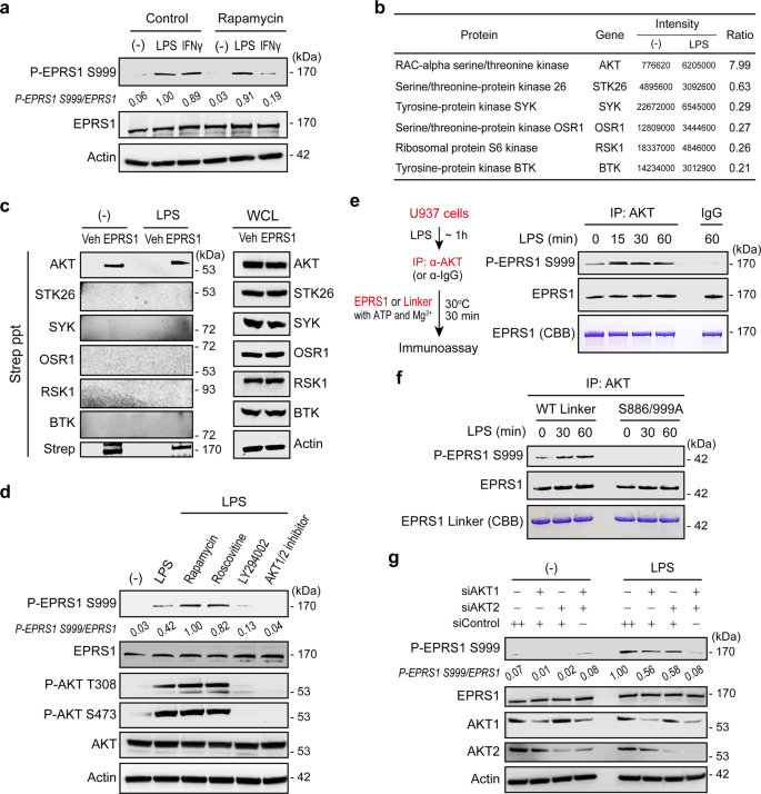 Fig. 2: Inflammatory-activated AKT phosphorylates EPRS1 at Ser999.