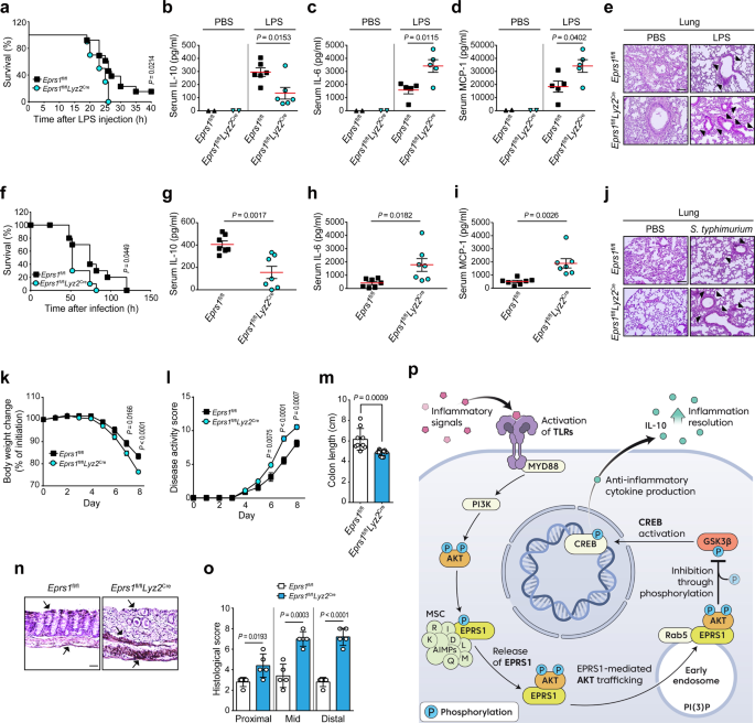 Fig. 6: EPRS1 protects mice from inflammatory insults.