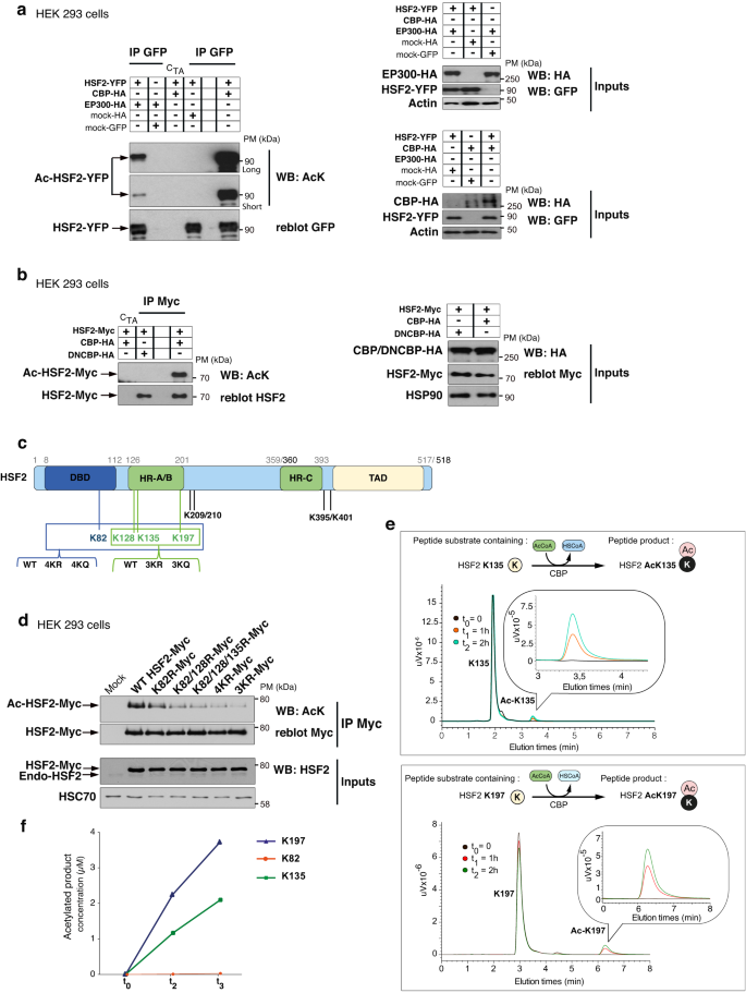 Ultra-Rare Syndromes: The Example of Rubinstein-Taybi Syndrome