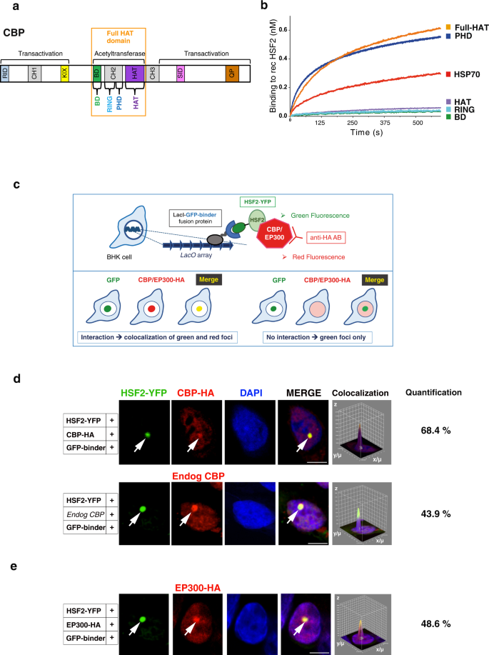 Rubinstein-Taybi Syndrome OMIM# 180849 - FDNA™