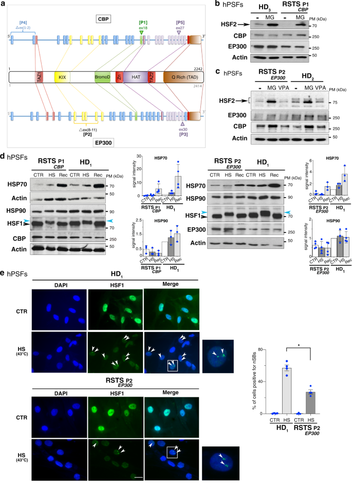 Rubinstein-Taybi Syndrome OMIM# 180849 - FDNA™