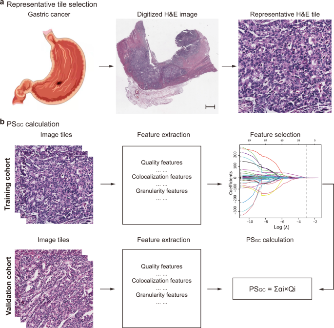 Fig. 1: Schematic illustration of PSGC construction.