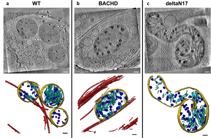Fig. 3: Mitochondria from neurites of HD mouse model neurons exhibit altered morphology and contain enlarged granules of varying size.