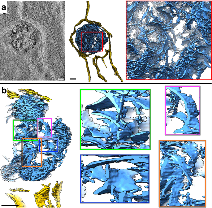 Fig. 4: Neurites in HD cells contain double membrane-bound compartments with sheet aggregates composed of interwoven slabs and sheets.
