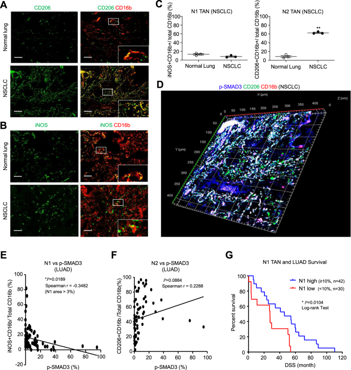 Fig. 1: SMAD3 activation is negatively associated with an N1 phenotype in NSCLC.