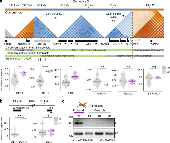 Fig. 3: Chromatin activity and gene expression evaluation of der(X).