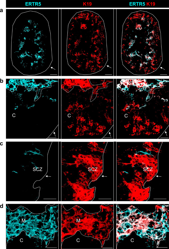 Fig. 2: K19+ TEC are widely distributed within thymic microenvironments.