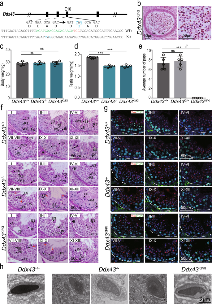Fig. 2: DDX43 mutant mice exhibit defects in spermatids.