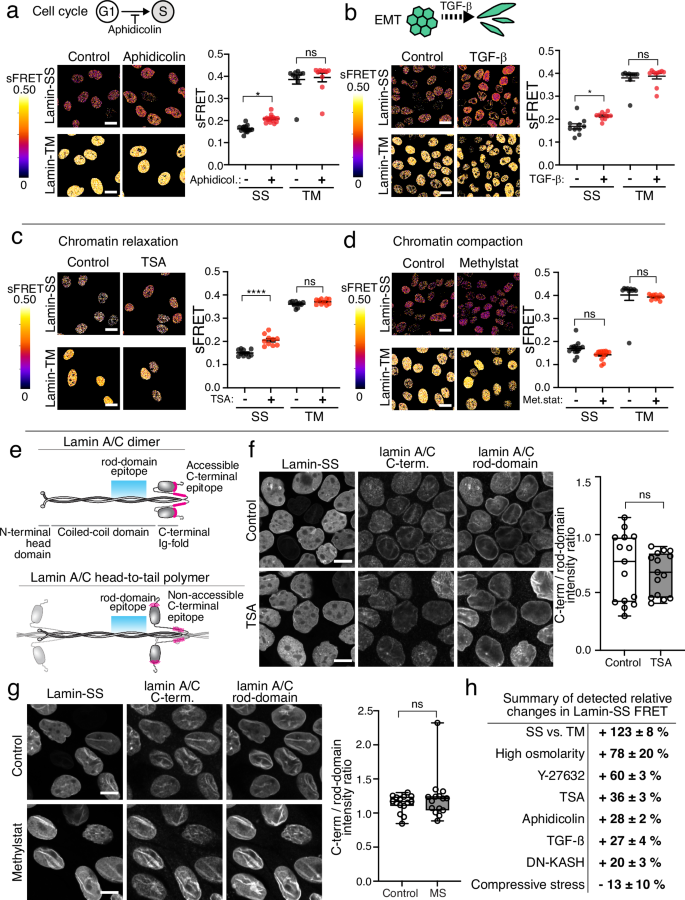 Fig. 4: The effect of cell cycle, EMT and chromatin organization on lamin A/C strain.