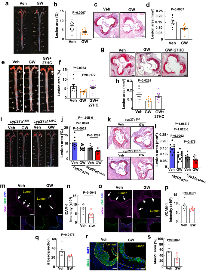 PDF) Abstract A74: Microparticles mediate cross-talk between tumoral and  endothelial cells and promote the constitution of an angiocrine  pro-metastatic niche through Arf6 up regulation