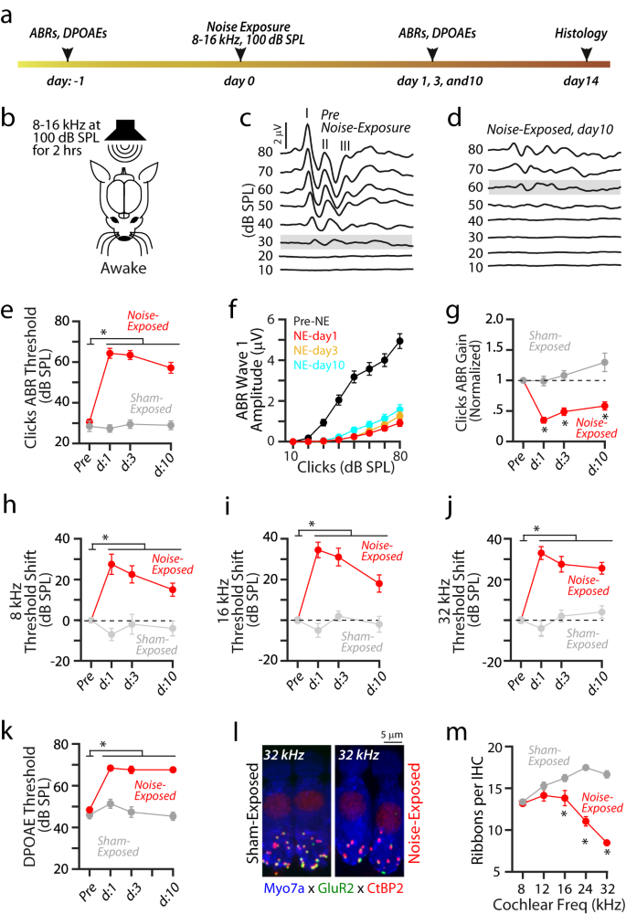 Fig. 1: Reduced sound-evoked activity of auditory nerve after NIHL.