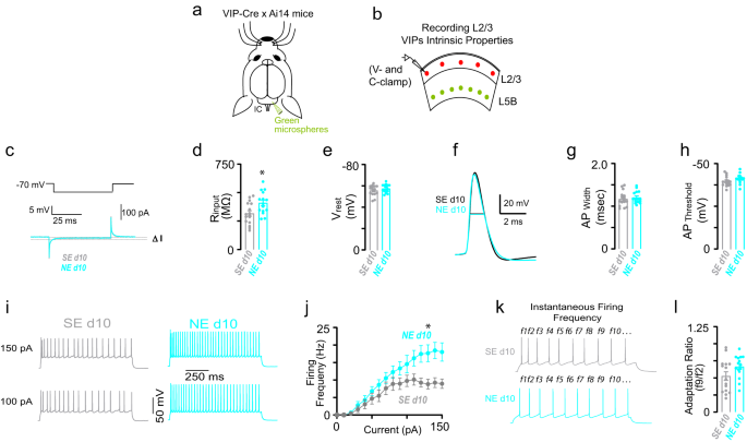 Fig. 9: Increased VIP intrinsic excitability after NIHL.