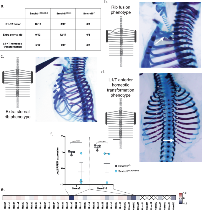 Fig. 2: MommeD43 has a gain of function effect on Hox gene silencing and skeletal development.