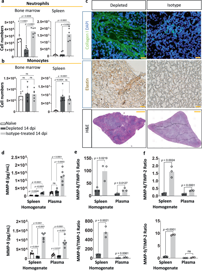 Fig. 7: Neutrophil depletion prevents the destruction of spleen architecture and ECM damage.