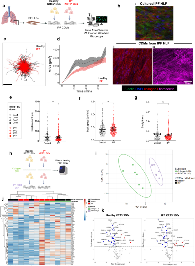 Lung extracellular matrix modulates KRT5+ basal cell activity in pulmonary  fibrosis