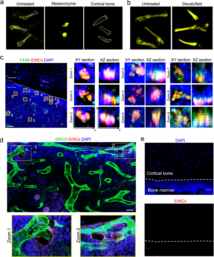 Fig. 2: Cell uptakes of ErNCs in mouse bone marrow.
