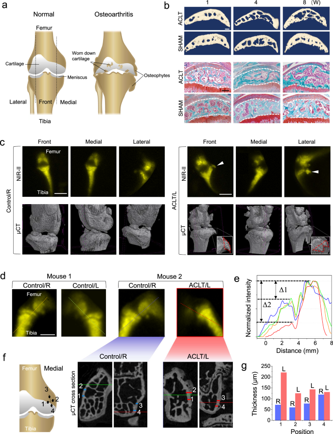 Fig. 5: In vivo NIR-II imaging on symptoms of osteoarthritis compared to μCT.
