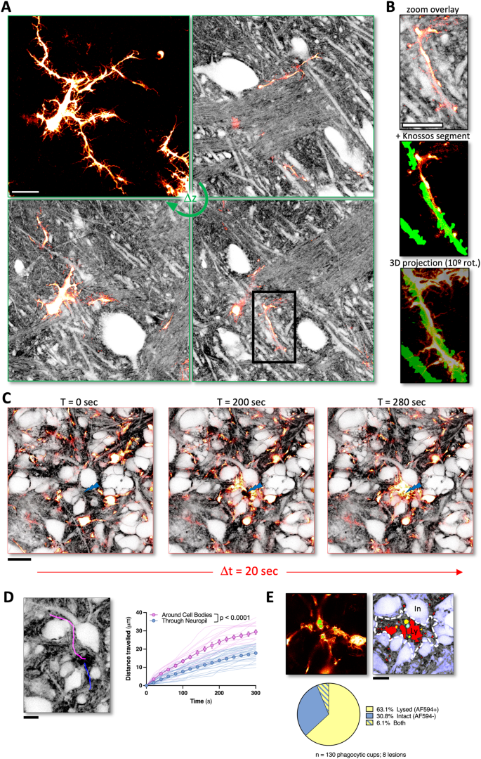 Shadow imaging for panoptical visualization of brain tissue in