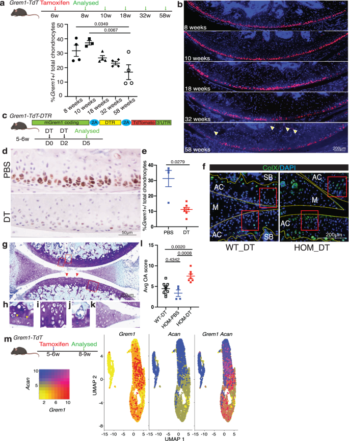 Fig. 3: Grem1-lineage articular progenitors cells are lost with age and targeted ablation causes OA.