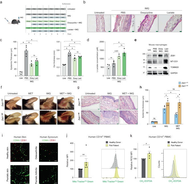 Fig. 5: Metformin requires ZEB1 expression in macrophages for its anti-inflammatory effects in psoriatic disease lesions.
