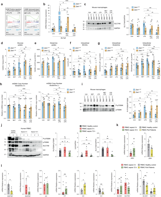 Fig. 6: ZEB1 inhibits mitochondrial protein translation by restricting amino acid transport.