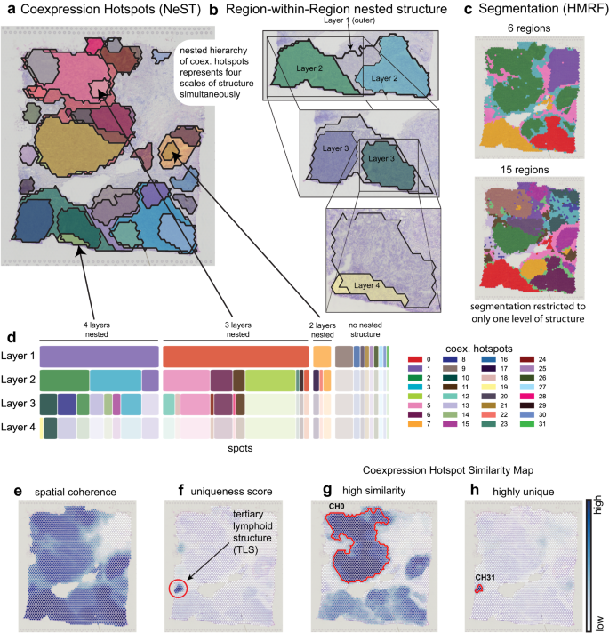Fig. 3: NeST simultaneously identifies four layers of hierarchical organization in breast cancer tissue.