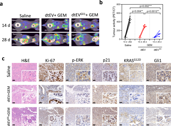 Fig. 8: Therapeutic efficacy of dtEVs in an orthotopic PDX mouse model.