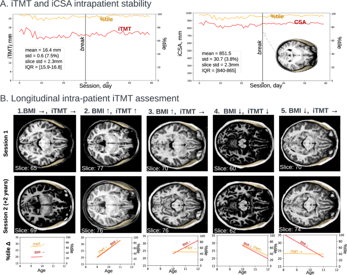 Fig. 6: Longitudinal intra-patient iTMT assessment.
