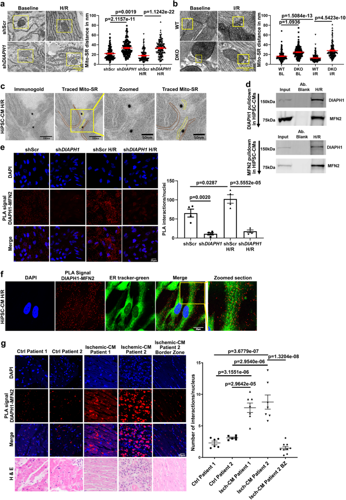 Fig. 1: DIAPH1 regulates Mitochondria(Mito)-SR/ER distance through interaction with MFN2.