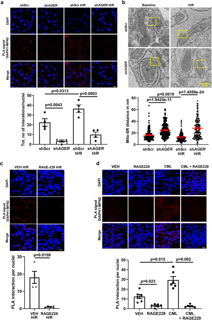 Fig. 6: RAGE–DIAPH1 regulates Mito-SR/ER distance and DIAPH1–MFN2 interactions in HiPSC-CMs.