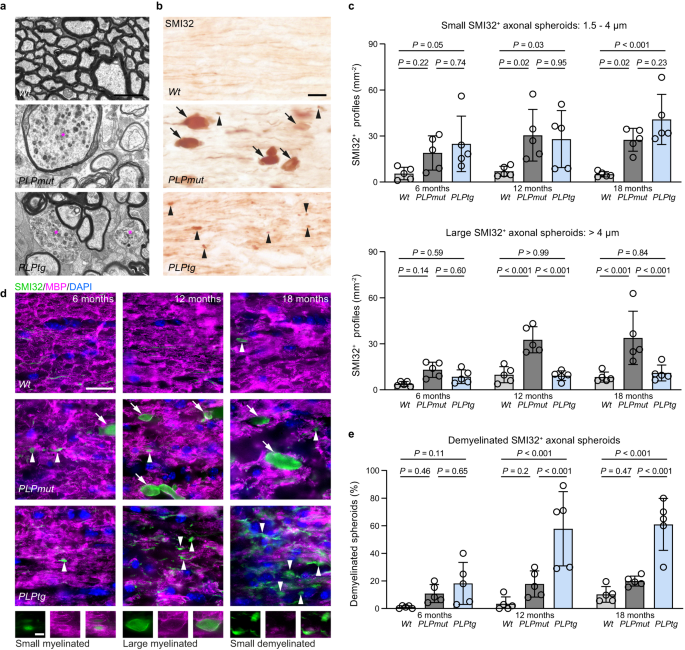 Fig. 2: Axonal spheroids show a similar initial formation but a different progression in mice with distinct PLP defects.